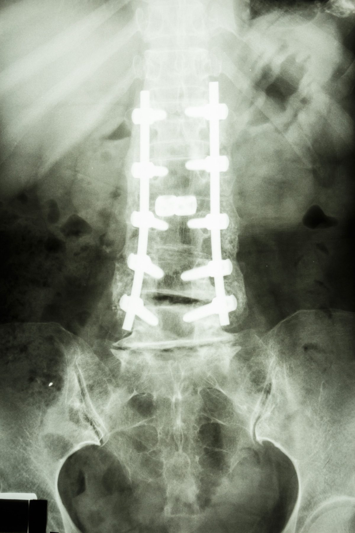 Columna con instrumentación